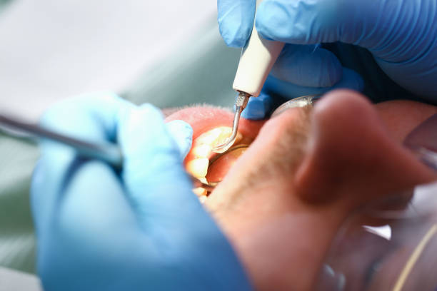 Best Emergency Treatment for Toothache in East Freehold, NJ